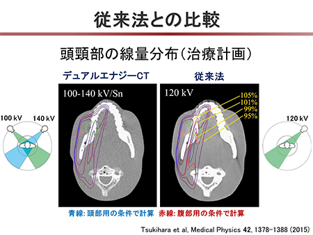 従来法との性能比較。デュアルエナジーCTでは条件が変わっても線量分布が安定・正確に得られる