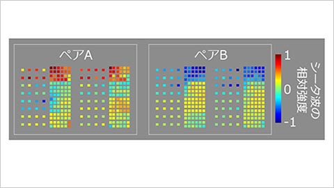 ペアとして連想学習した図形は、内側側頭葉において類似したシータ波の空間パターンを生じるようになる