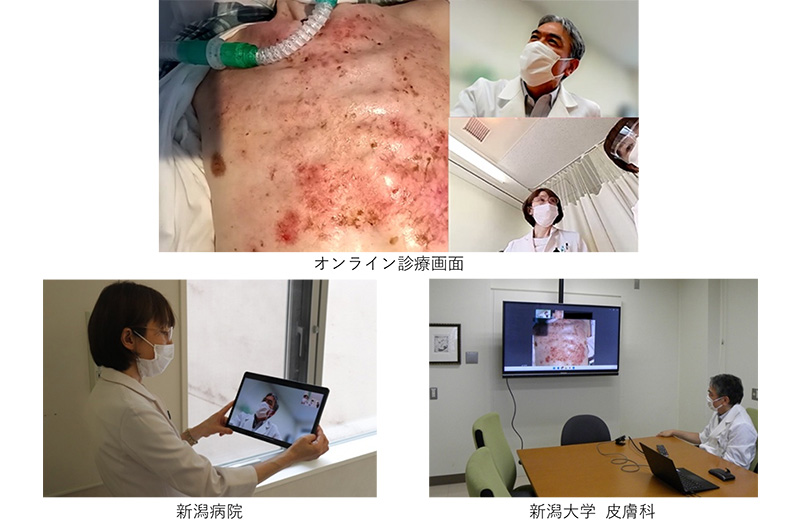 新潟病院での遠隔診療支援のイメージ写真